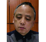 粟爱平